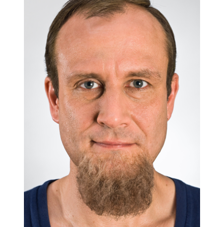 Chinbeard Blond